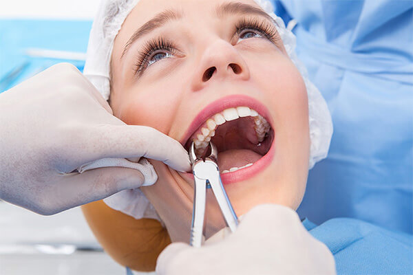 The Role of Dentists in Tooth Extraction