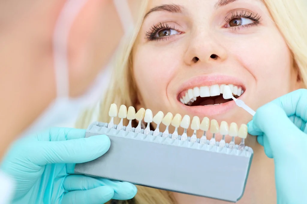 Preferred Techniques to Keep Your Teeth White and Bright
