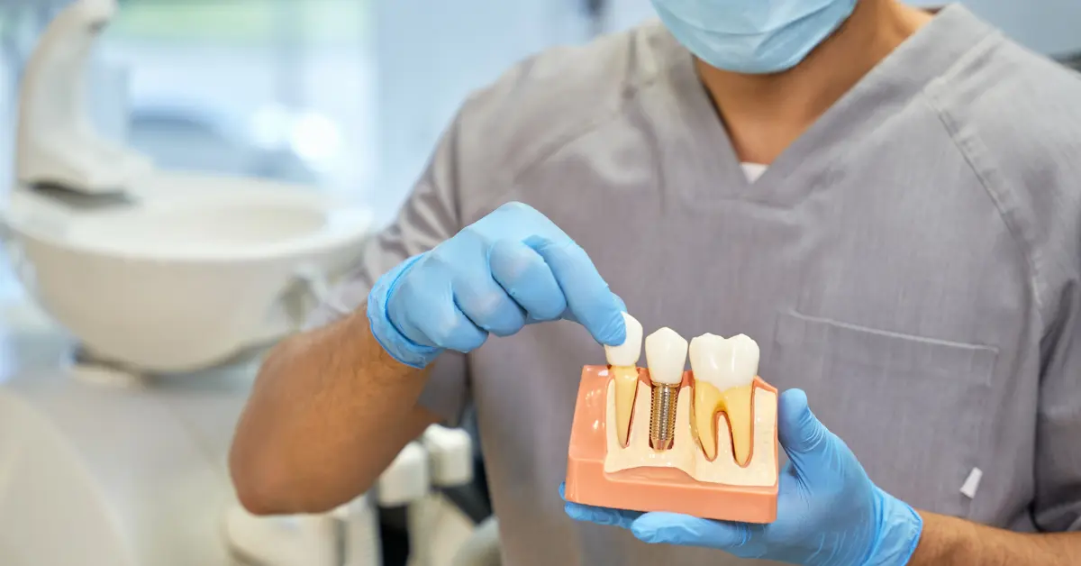 Dental Implant in Calgary