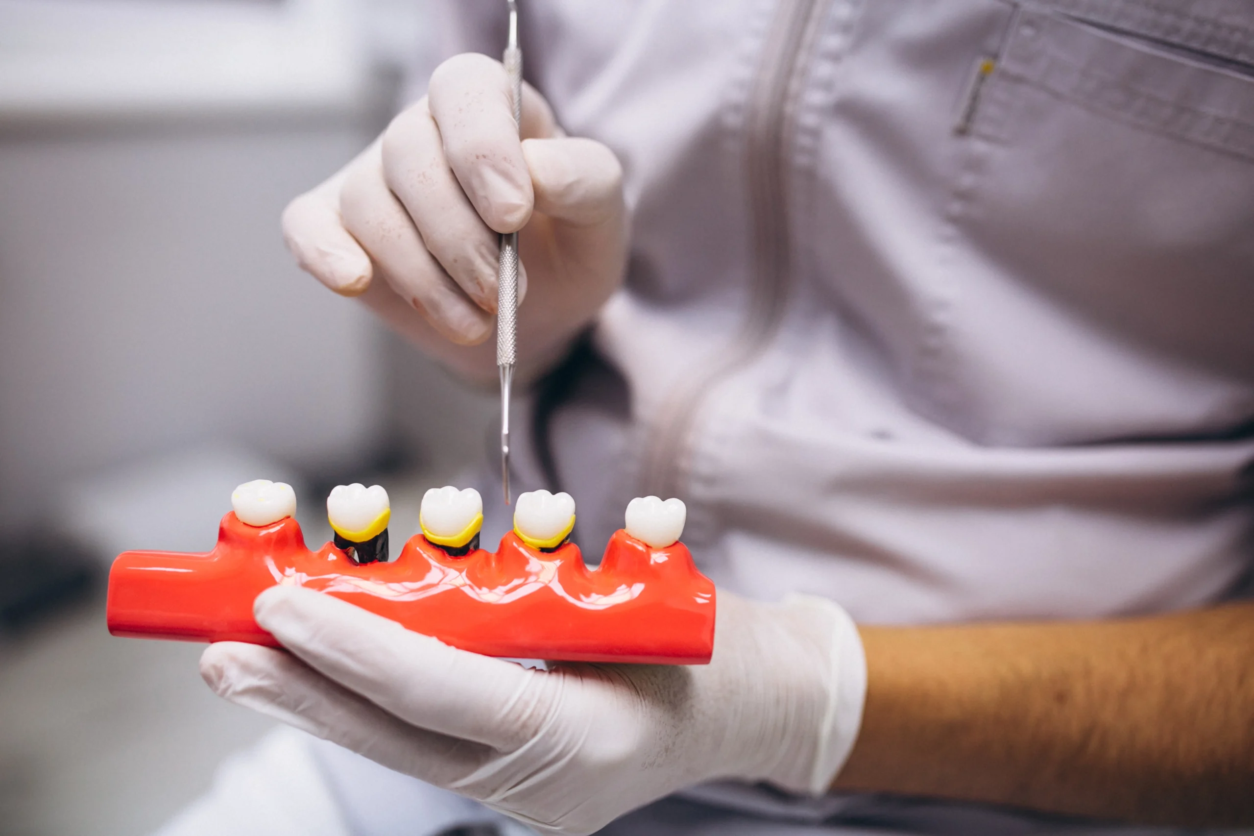 dental-crowns-and-bridges