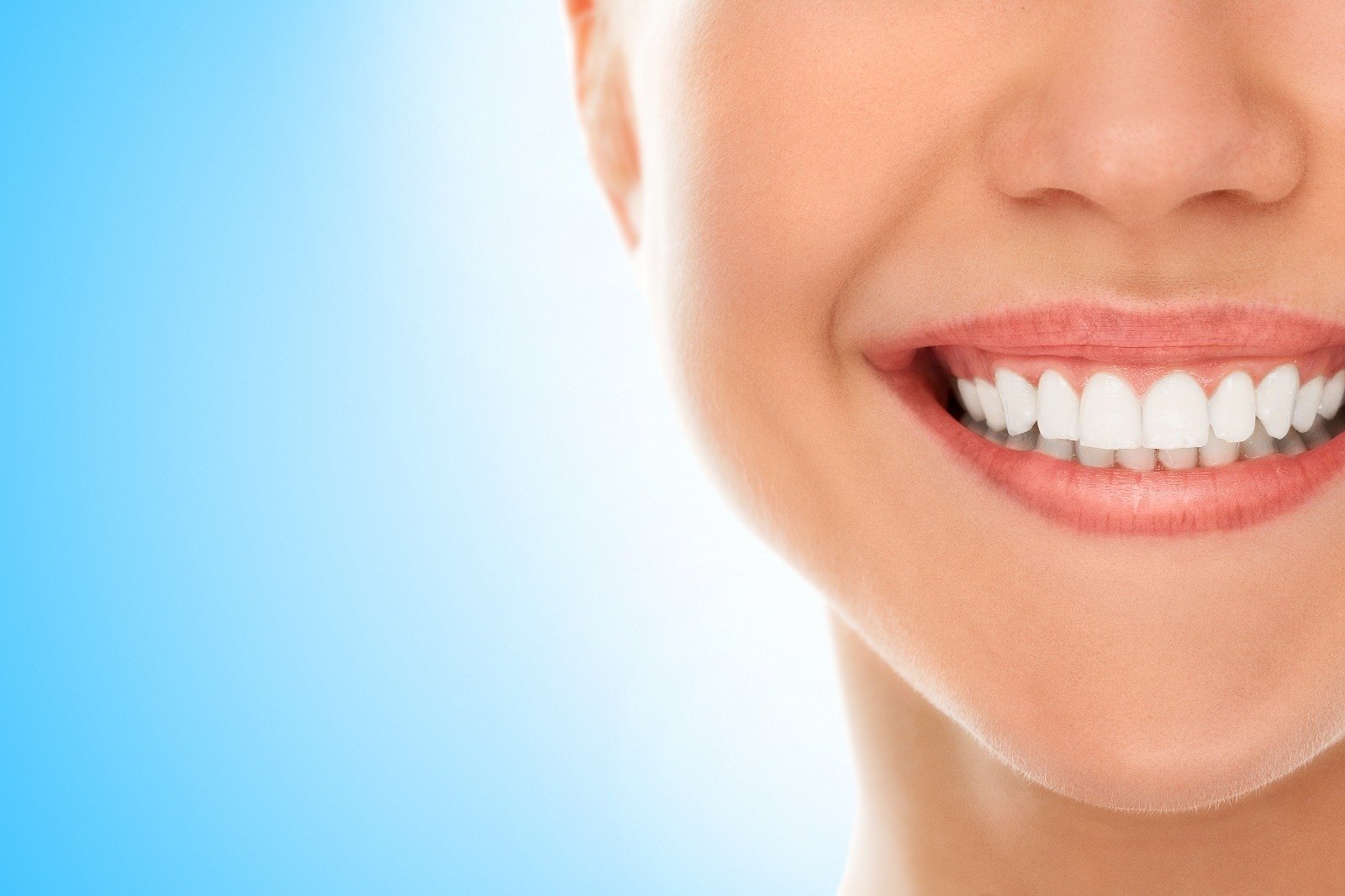 take home whitening vs laser