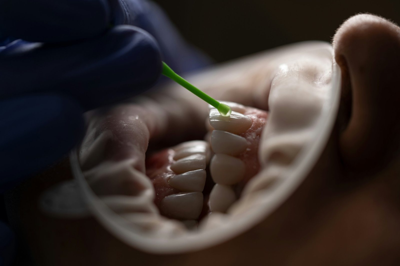 Professional Teeth Cleaning