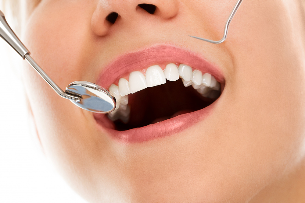 Teeth cleaning Calgary