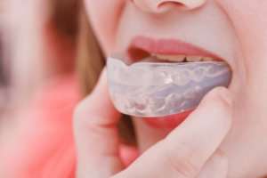 sports requiring mouthguards