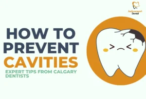 How to Prevent Cavities Expert Tips from Calgary Dentists