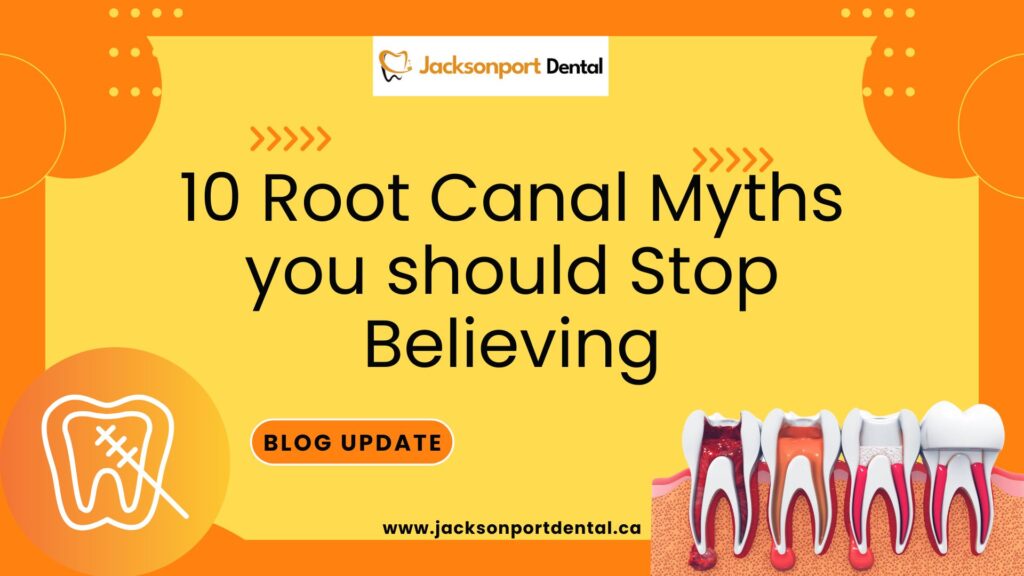 root canal myths