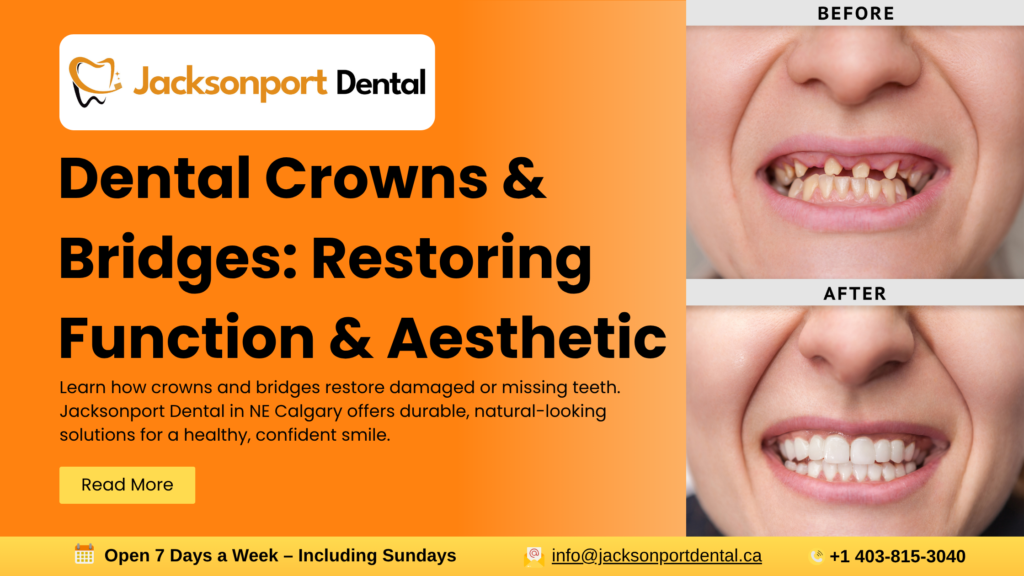 Dental Crowns & Bridges