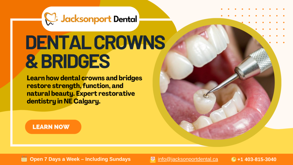 Dental Crowns & Bridges in Calgary: Restoring Function, Strength, and Natural Beauty