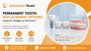 Promotional banner from Jacksonport Dental comparing permanent tooth replacement options. The image displays a dental implant, a dental bridge, and dentures with the headline 'Permanent Tooth Replacement Options: Implants, Bridges or Dentures?' and contact information for the Calgary dental clinic