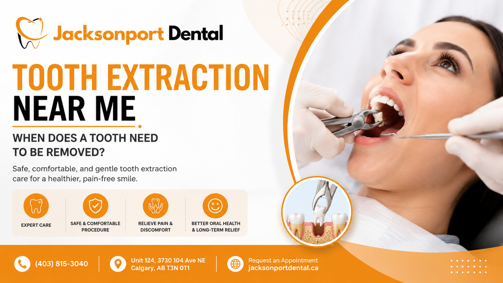 Tooth extraction near me in Calgary – Jacksonport Dental Clinic NE Calgary providing safe and comfortable tooth extractions, wisdom tooth removal, emergency dental care, and personalized treatment by Dr. Richa Bhatnagar.